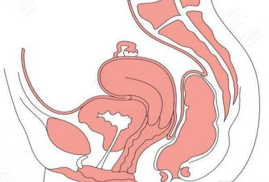 宫颈欠光滑有什么影响