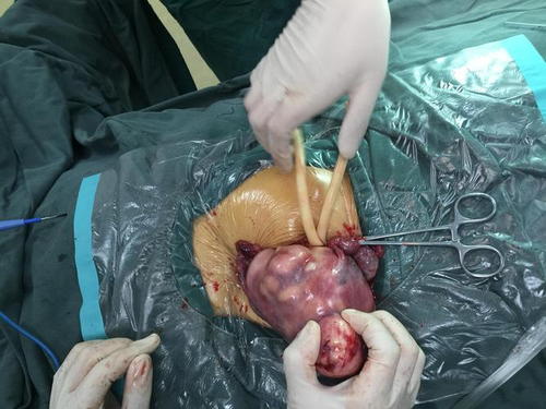 宫颈能不能切除 宫颈能不能切除