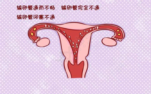 宫颈口松弛怎么检查 宫颈口松弛怎么检查