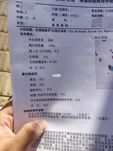 宫颈糜烂去医院怎么检查 宫颈糜烂去医院怎么检查