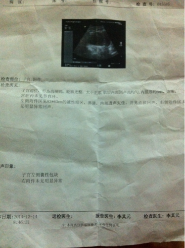 子宫四公分囊肿怎么办 子宫四公分囊肿怎么办