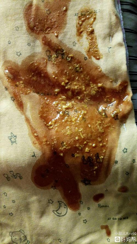 大便颜色发红怎么回事肚子疼 大便颜色发红怎么回事肚子疼