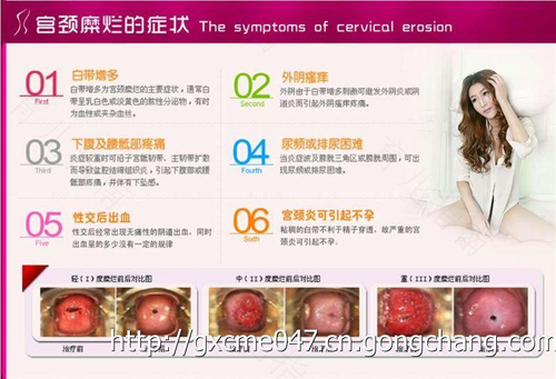 宫颈糜烂与性有关系吗 宫颈糜烂与性有关系吗