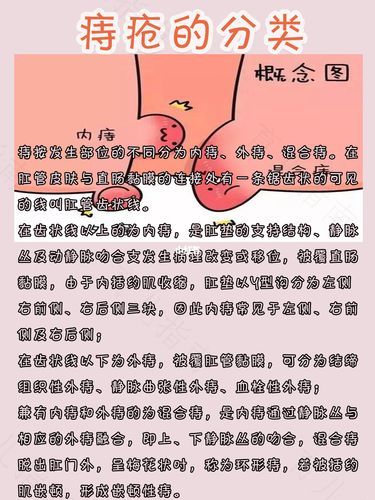 形成痔疮的原因有哪些? 形成痔疮的原因有哪些?