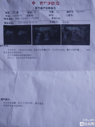 做彩超憋尿一直没有怎么办 做彩超憋尿一直没有怎么办