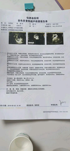 腹腔积水严重吗能治好吗