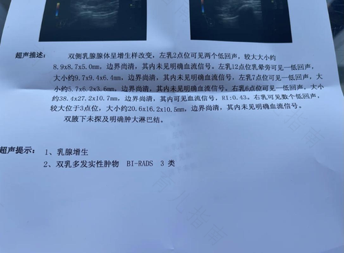 乳腺结节三级严重吗,要手术吗 乳腺结节三级严重吗,要手术吗