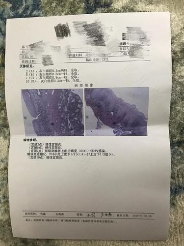 宫颈检查多久出结果 宫颈检查多久出结果