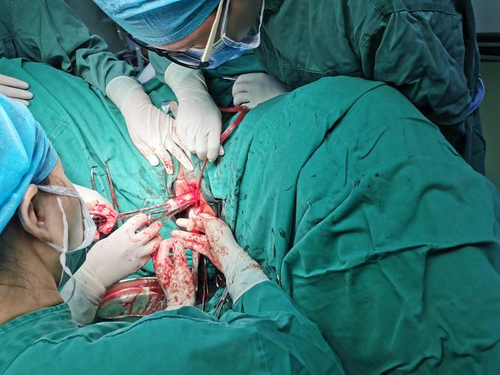 宫颈能不能全部切除手术