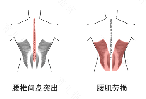 腰困是怎么回事男性 腰困是怎么回事男性