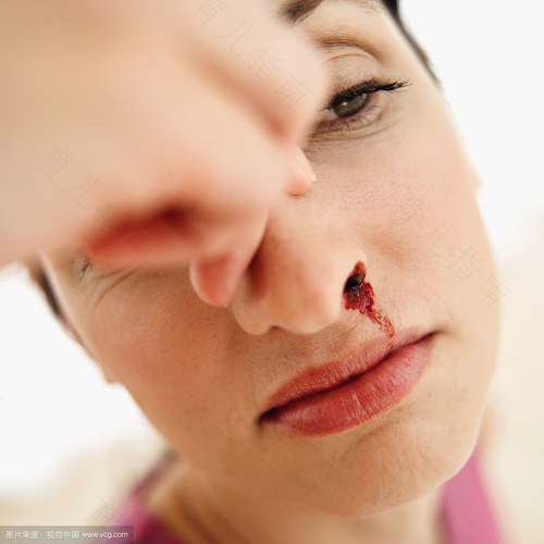 鼻子总爱出血是怎么回事 鼻子总爱出血是怎么回事