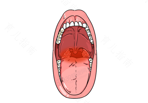 怀孕咽炎咳嗽厉害怎么办 怀孕咽炎咳嗽厉害怎么办