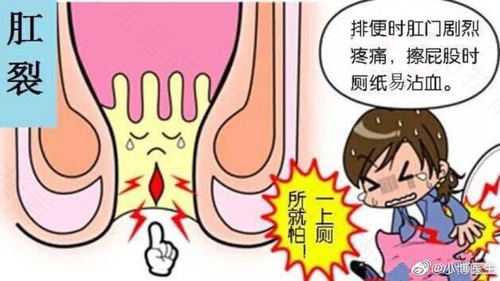 产后大便肛门疼痛怎么办