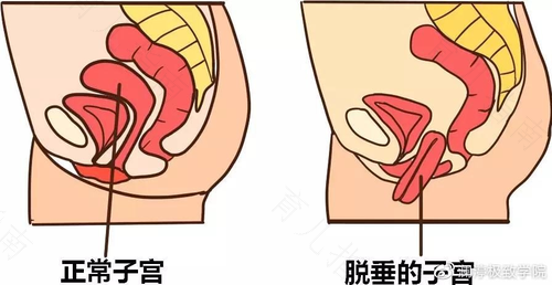 宫颈几点怎么分
