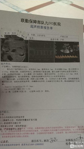 先天性胆道闭锁能活多久 先天性胆道闭锁能活多久