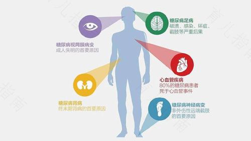 2型糖尿病并发症症状概率 2型糖尿病并发症症状概率