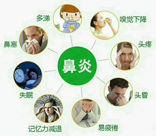 鼻炎自己会好吗? 鼻炎自己会好吗?