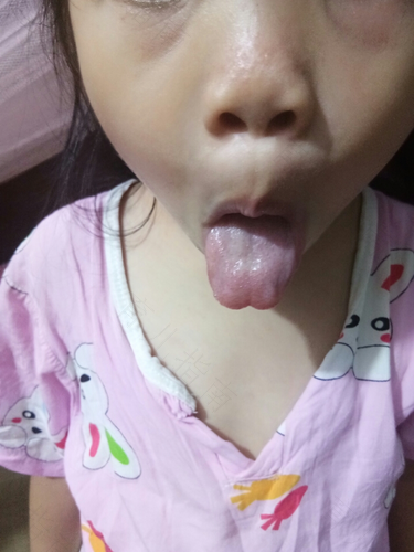 脾胃不好经常口臭怎么办