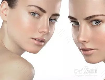 全身容易出油怎么办 全身容易出油怎么办