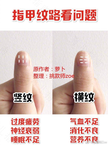 营养不良手指甲是怎么样的