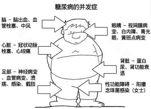 糖尿病的晚期症状有哪些症状 糖尿病的晚期症状有哪些症状