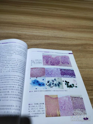 宫颈管腺上皮细胞是什么意思