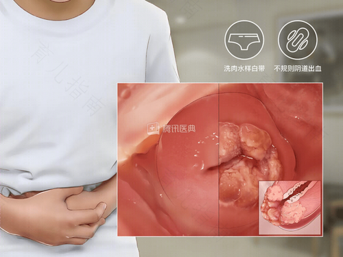 宫颈切了还会长出来吗 宫颈切了还会长出来吗