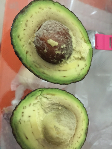 肺结核能不能吃牛油果吗 肺结核能不能吃牛油果吗