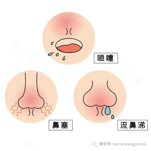 孩子鼻子里有鼻屎怎么清理 孩子鼻子里有鼻屎怎么清理