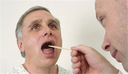 慢性咽炎老咳嗽怎么办 慢性咽炎老咳嗽怎么办