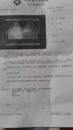 儿童腹腔积液严重吗