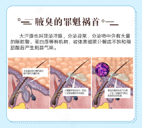 狐臭做微创手术好吗 狐臭做微创手术好吗