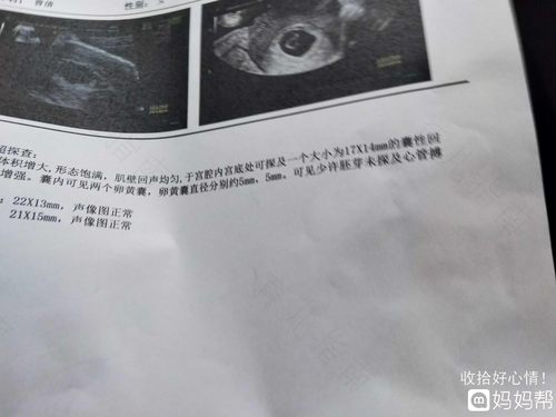 60天才刚有卵黄囊 60天才刚有卵黄囊