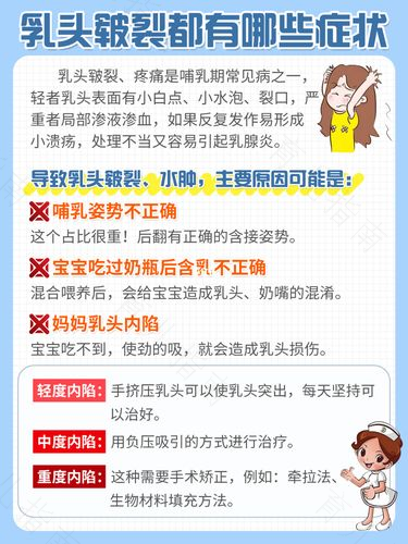 乳头疮怎么治疗 乳头疮怎么治疗