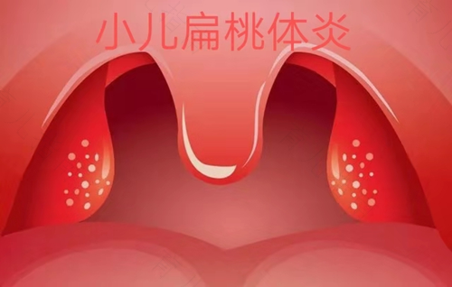 宝宝扁桃体发炎引起咳嗽怎么办
