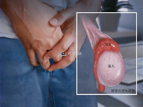 突然一边蛋疼怎么回事 突然一边蛋疼怎么回事