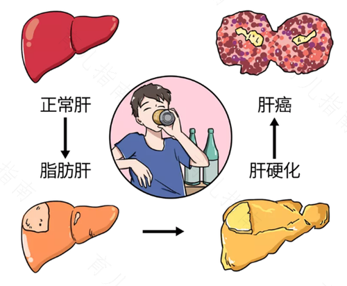 肝病毒感染会传染吗 肝病毒感染会传染吗