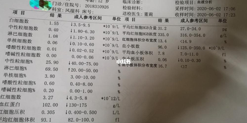 淋巴细胞低怎么回事啊 淋巴细胞低怎么回事啊