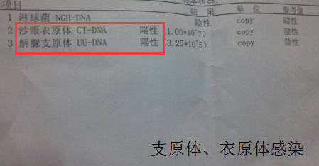 衣原体感染治疗后多久复查 妈妈网 衣原体感染治疗后多久复查 妈妈网
