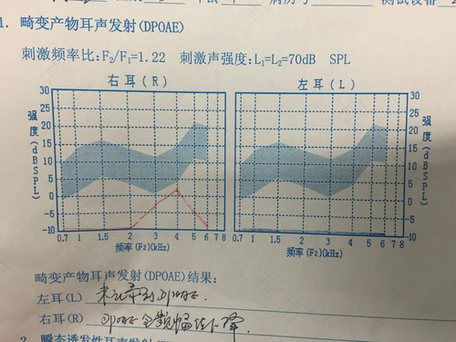 耳声发射未通过严重吗 耳声发射未通过严重吗