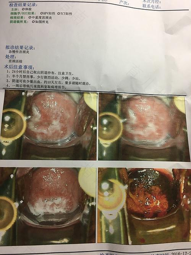 生完孩子宫颈有炎症怎么办