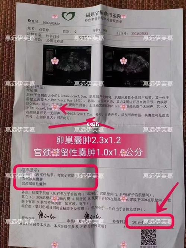 宫颈多发潴留囊肿严重吗?怎么治疗 宫颈多发潴留囊肿严重吗?怎么治疗