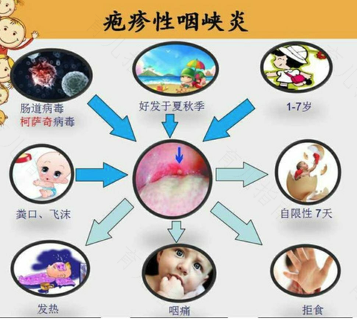 手足口病症状初期会发烧吗 手足口病症状初期会发烧吗