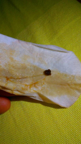 流完产不来月经是怎么回事 流完产不来月经是怎么回事