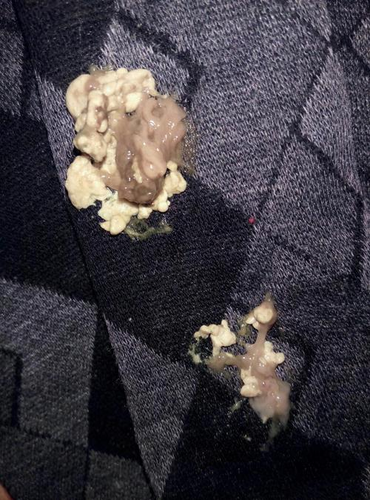 小牛拉黑色的粪便是怎么回事