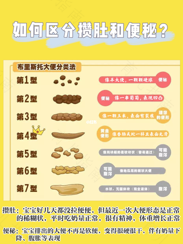 大便总是干硬怎么办 大便总是干硬怎么办