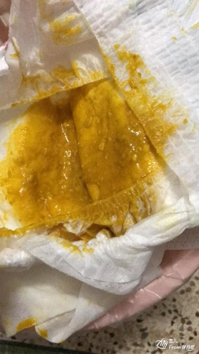 宝宝拉稀水样便是怎么回事 宝宝拉稀水样便是怎么回事