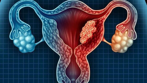 子宫颈癌多发生在什么年龄