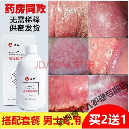 包茎污垢怎么去除 包茎污垢怎么去除