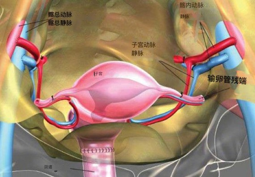 子宫血管扩张什么原因造成的 子宫血管扩张什么原因造成的